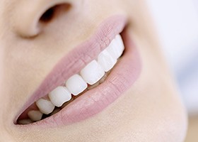 Closeup of smile with porcelain veneers