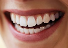 Closeup of smile with natural looking tooth replacement