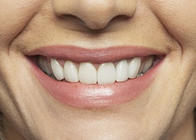 Closeup of flawless healthy smile