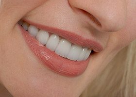Closeup of healthy teeth